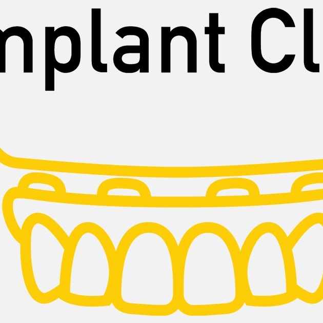 Jos  Implant